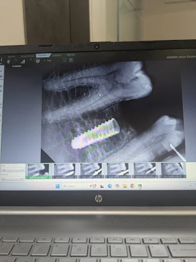 Pooja Smile Care Dental Gallery Image 14